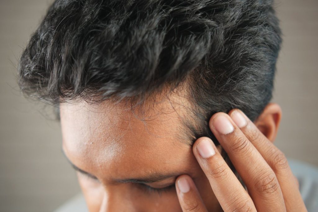 What Causes Hair Loss in Men?