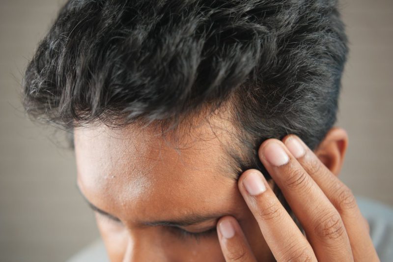 What Causes Hair Loss in Men