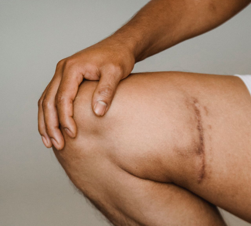 When Should I Consider Knee Replacement?