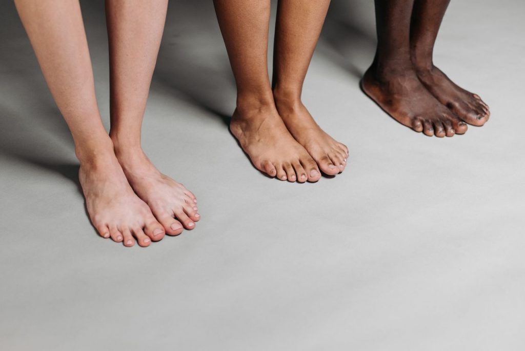 Why Do My Feet Change Color?